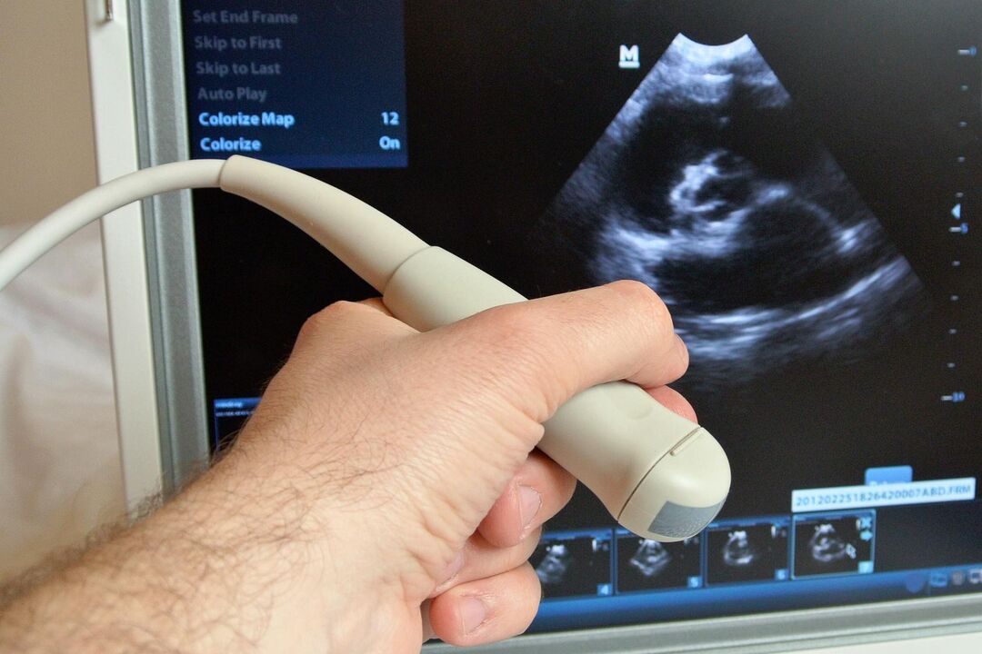 Ultraschall hilft bei der Diagnose einer kongestiven Prostatitis bei einem Mann
