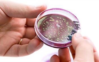 Bakterien im Sekret der Prostata